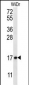 TBCA Antibody (N-term)